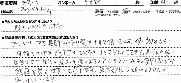 ファンガクリームレビュー2